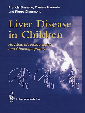 Liver Disease in Children