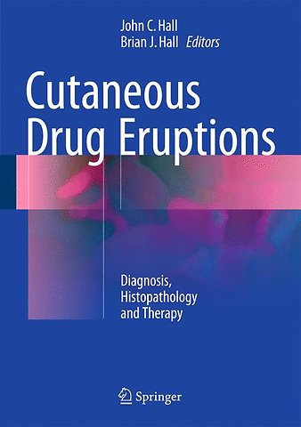 Cutaneous Drug Eruptions
