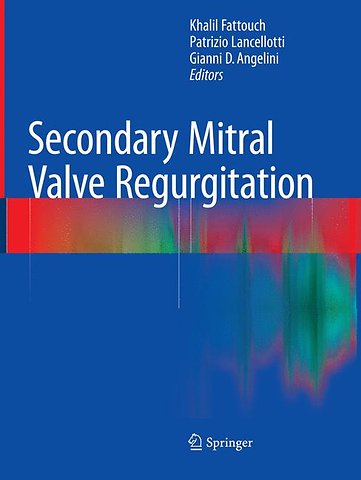 Secondary Mitral Valve Regurgitation