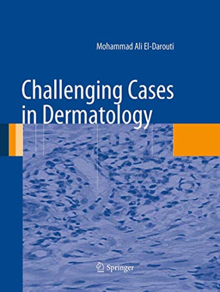 Challenging Cases in Dermatology