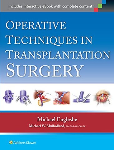 Operative Techniques in Transplantation Surgery
