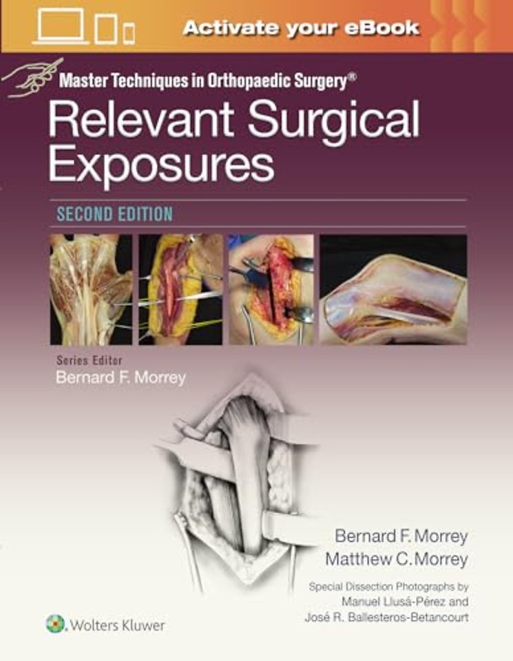 Master Techniques in Orthopaedic Surgery: Relevant Surgical Exposures