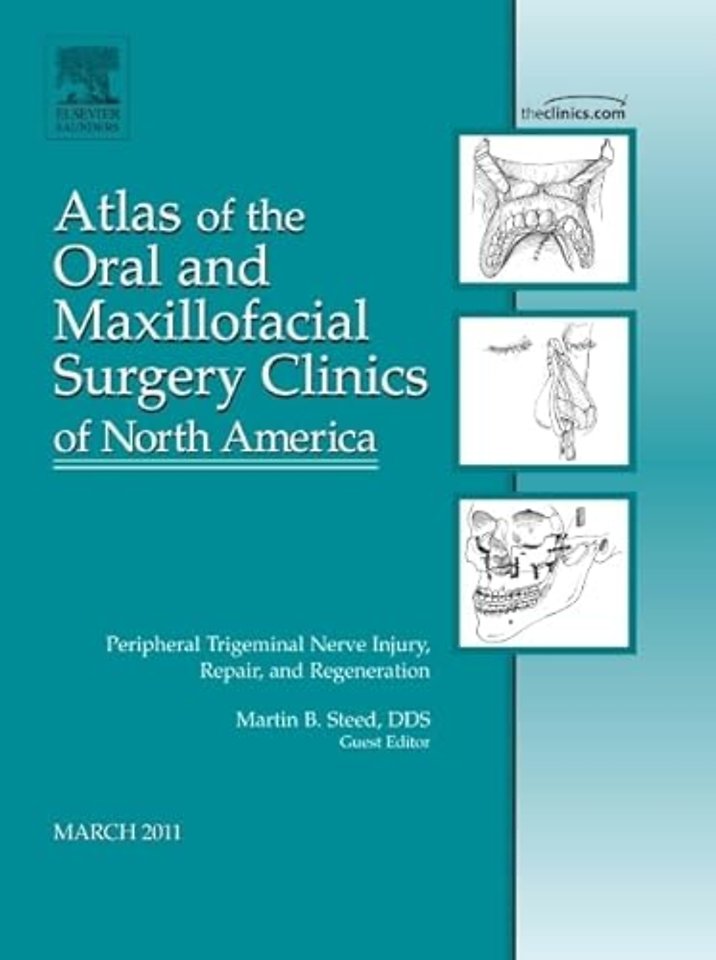 Peripheral Trigeminal Nerve Injury, Repair, and Regeneration, An Issue of Atlas of the Oral and Maxillofacial Surgery Clinics