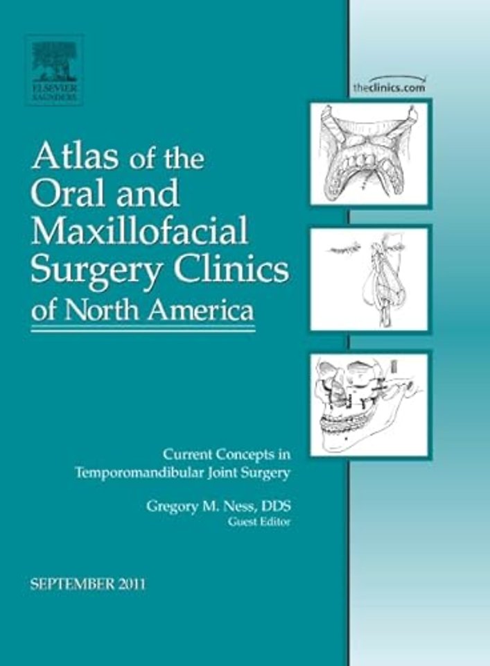 Current Concepts in Temporomandibular Joint Surgery, An Issue of Atlas of the Oral and Maxillofacial Surgery Clinics