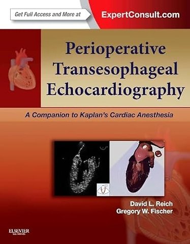 Perioperative Transesophageal Echocardiography