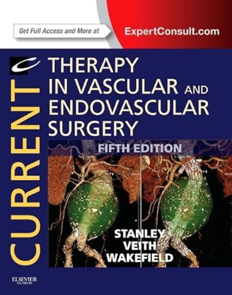 Current Therapy in Vascular and Endovascular Surgery