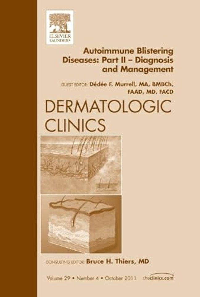 Autoimmune Blistering Diseases, Part II - Diagnosis and Management, An Issue of Dermatologic Clinics