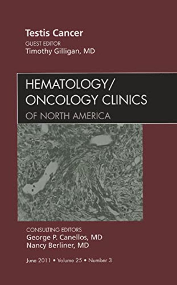Testes Cancer, An Issue of Hematology/Oncology Clinics of North America