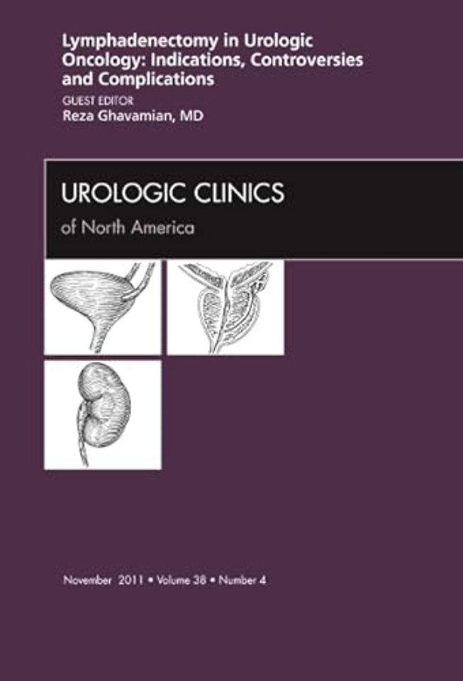 Lyphadenctomy in Urologic Oncology: Indications, Controversies, and Complications, An Issue of Urologic Clinics