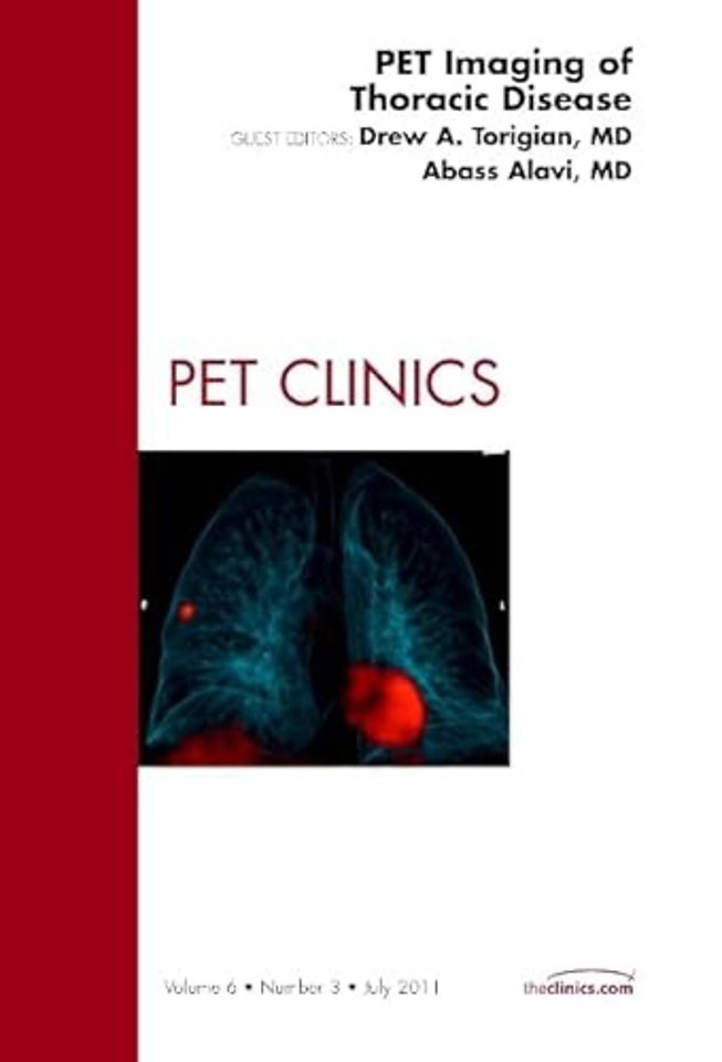 PET Imaging of Thoracic Disease, An Issue of PET Clinics