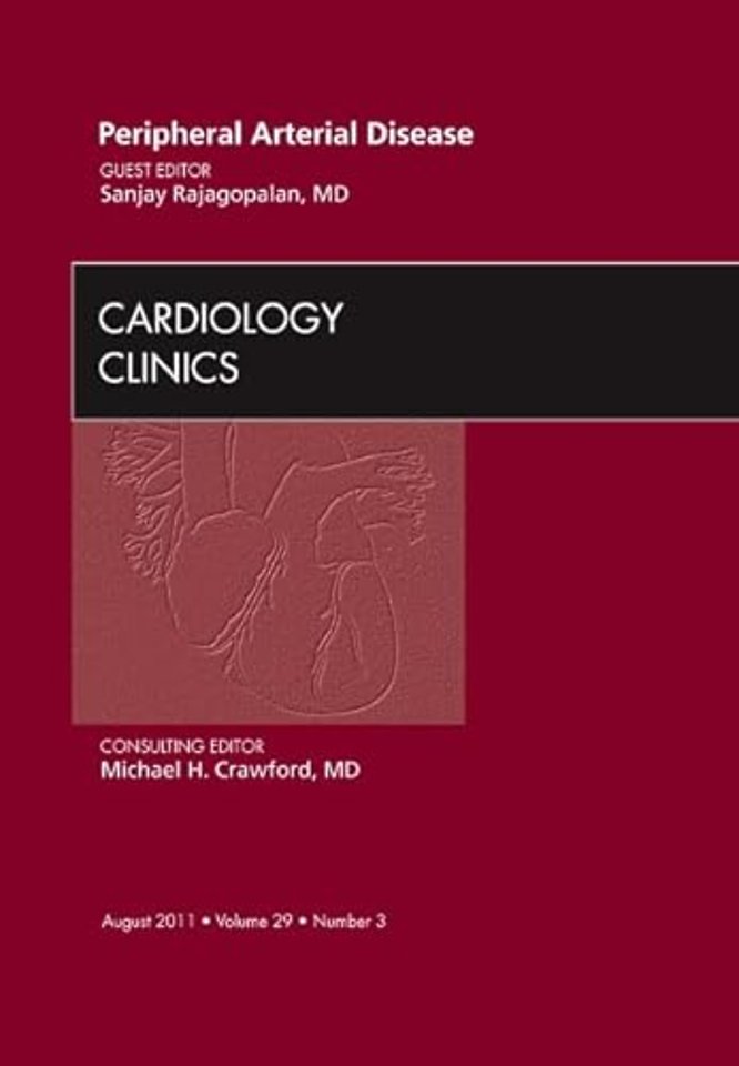 Peripheral Arterial Disease, An Issue of Cardiology Clinics