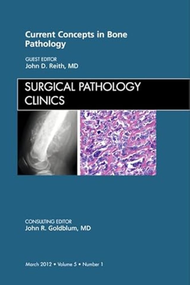 Current Concepts in Bone Pathology, An Issue of Surgical Pathology Clinics