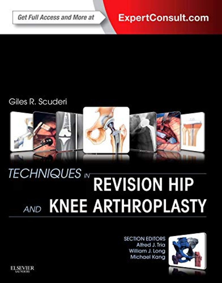 Techniques in Revision Hip and Knee Arthroplasty