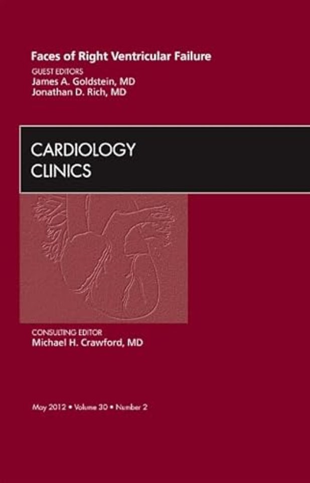 Faces of Right Ventricular Failure, An Issue of Cardiology Clinics