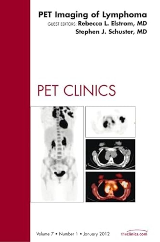 PET Imaging of Lymphoma, An Issue of PET Clinics
