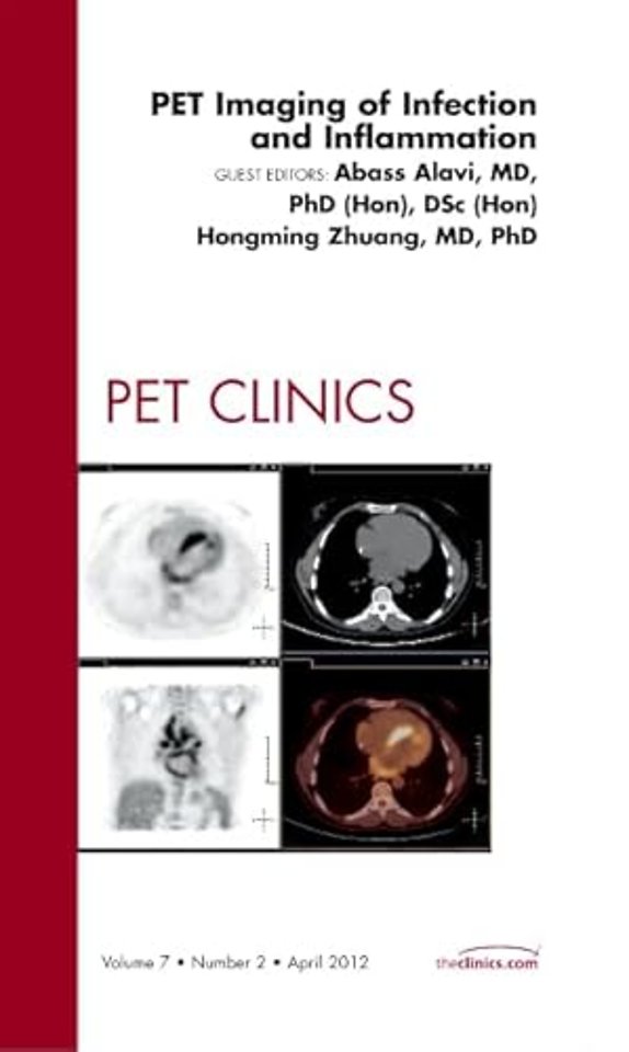 PET Imaging of Infection and Inflammation, An Issue of PET Clinics