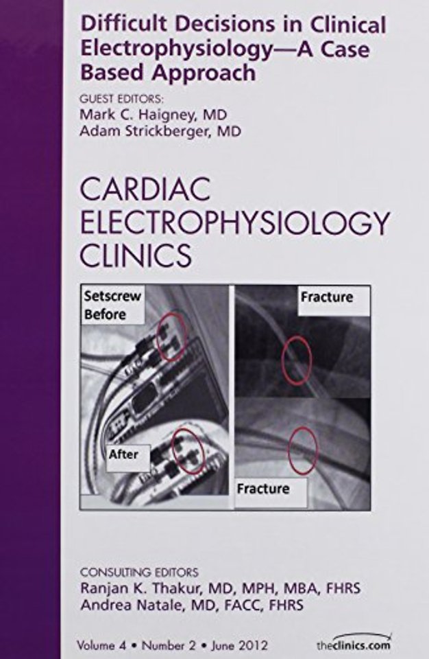 Difficult Decisions in Clinical Electrophysiology - A Case Based Approach, An Issue of Cardiac Electrophysiology Clinics