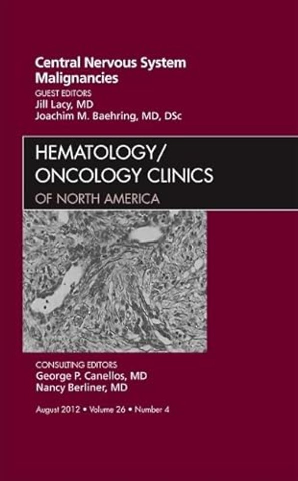 Central Nervous System Malignancies, An Issue of Hematology/Oncology Clinics of North America