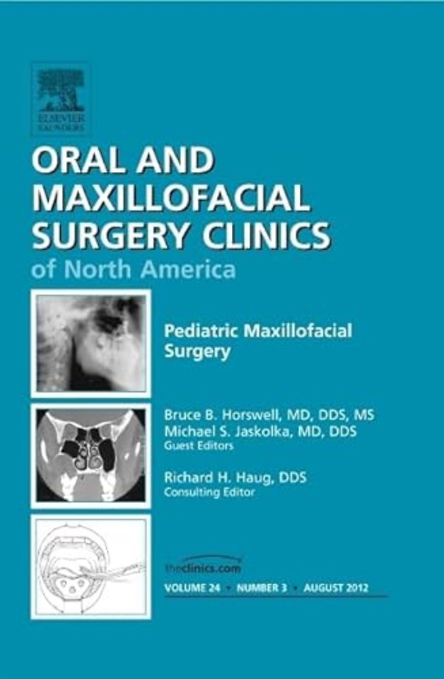 Pediatric Maxillofacial Surgery, An Issue of Oral and Maxillofacial Surgery Clinics