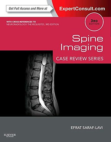 Spine Imaging: Case Review Series