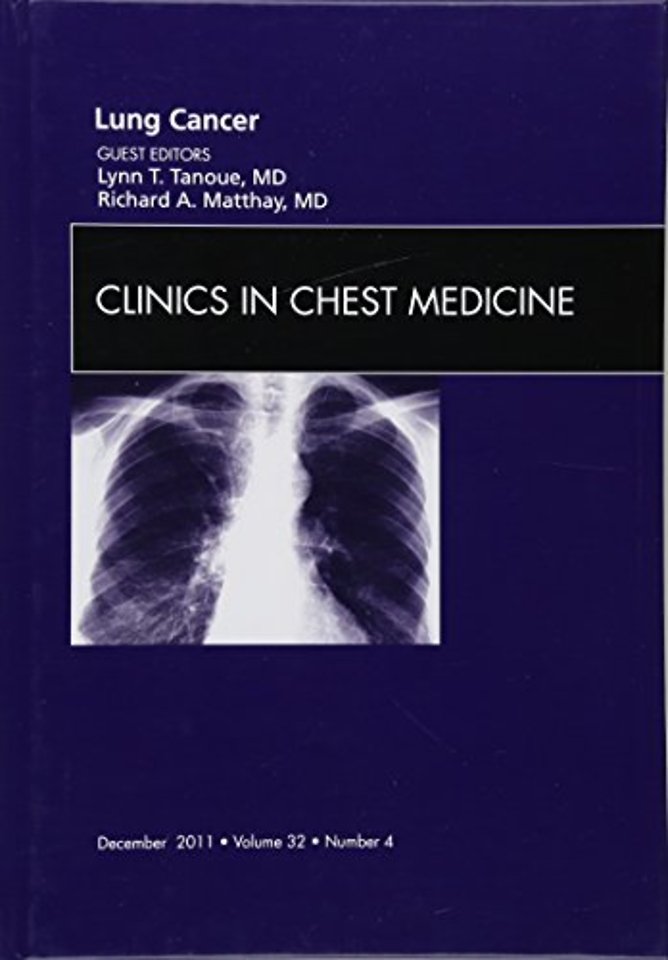 Lung Cancer, An Issue of Clinics in Chest Medicine