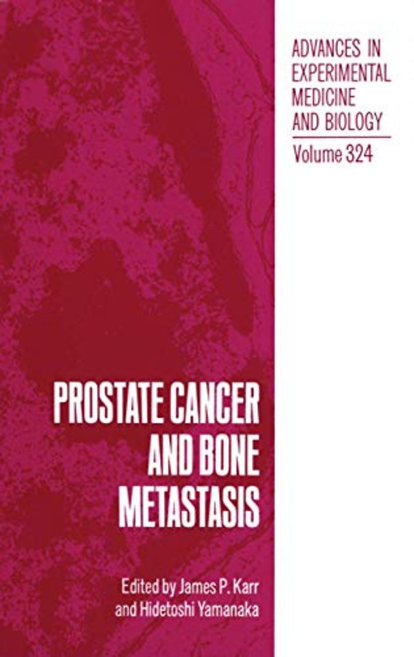 Prostate Cancer and Bone Metastasis