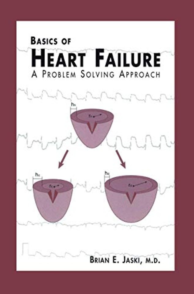 Basics of Heart Failure