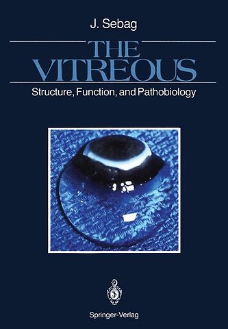 The Vitreous
