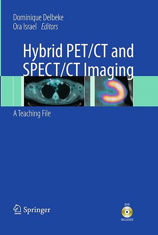 Hybrid PET/CT and SPECT/CT Imaging