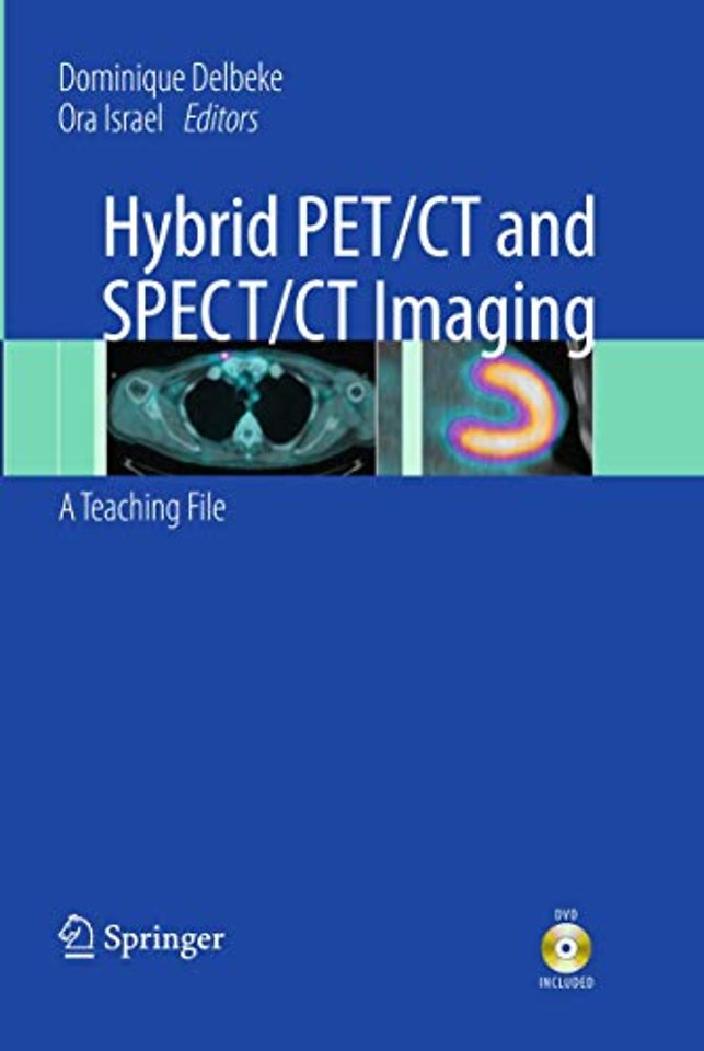Hybrid PET/CT and SPECT/CT Imaging