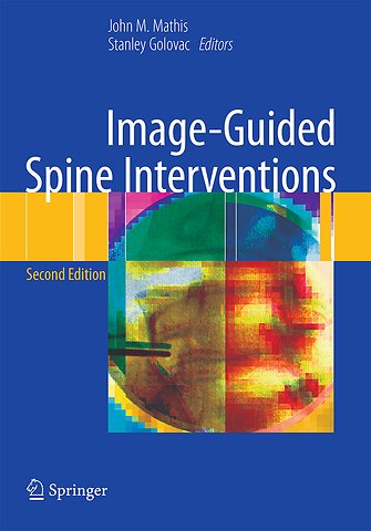 Image-Guided Spine Interventions