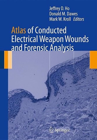 Atlas of Conducted Electrical Weapon Wounds and Forensic Analysis