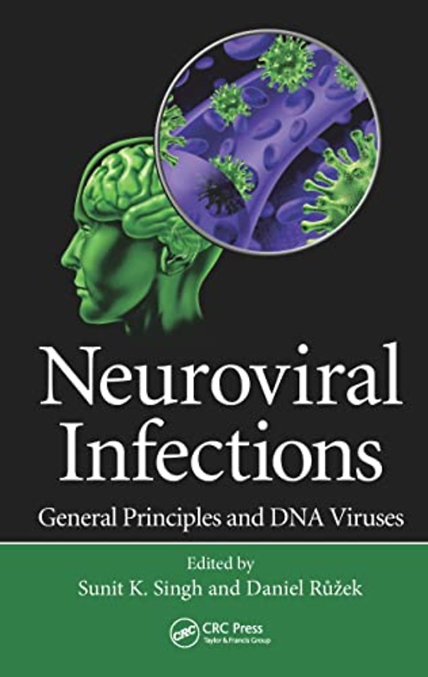 Neuroviral Infections