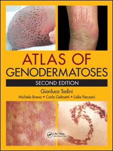 Atlas of Genodermatoses