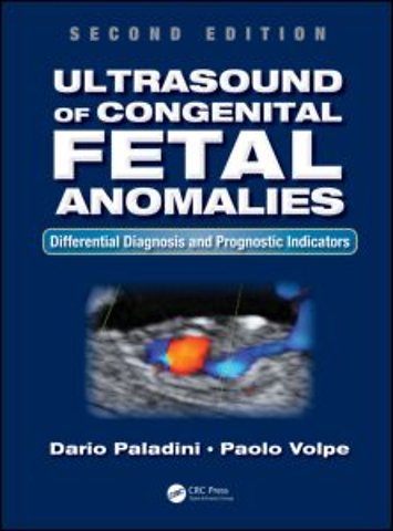 Ultrasound of Congenital Fetal Anomalies