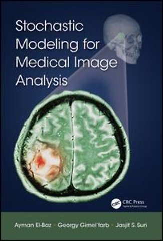Stochastic Modeling for Medical Image Analysis