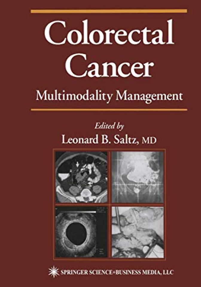 Colorectal Cancer