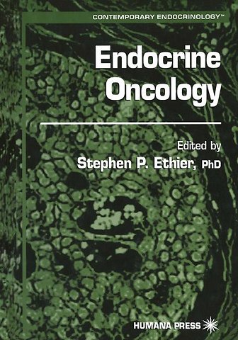 Endocrine Oncology