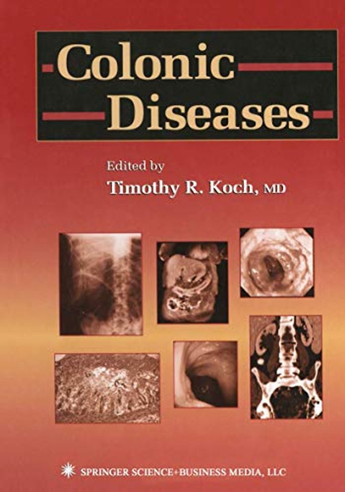 Colonic Diseases