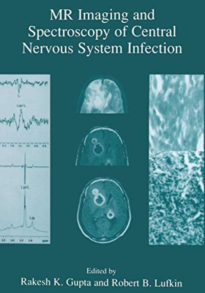 MR Imaging and Spectroscopy of Central Nervous System Infection