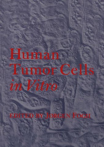 Human Tumor Cells in Vitro
