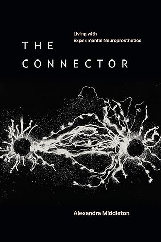 The Connector – Living with Experimental Neuroprosthetics