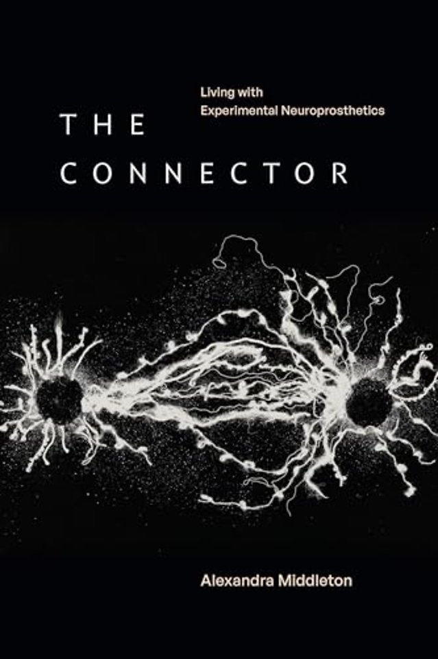 The Connector – Living with Experimental Neuroprosthetics