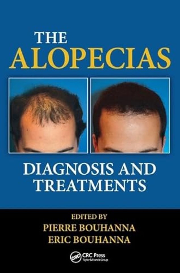Alopecias