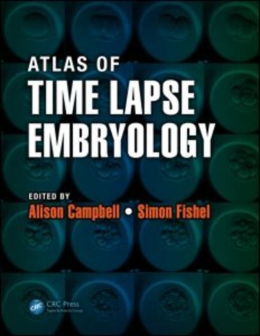 Atlas of Time Lapse Embryology