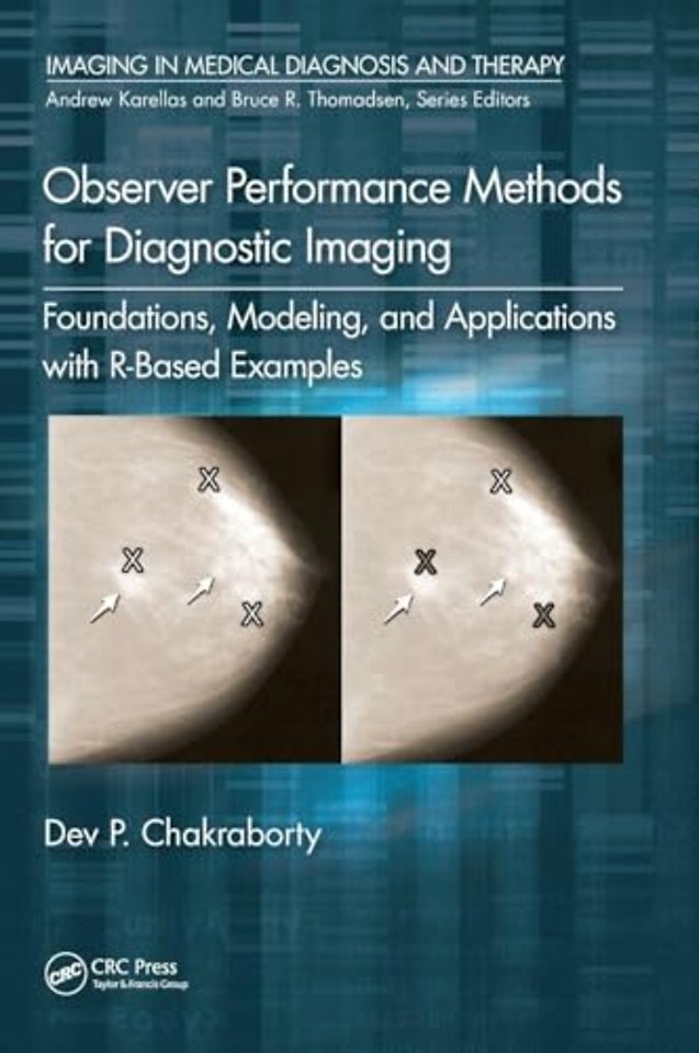 Observer Performance Methods for Diagnostic Imaging