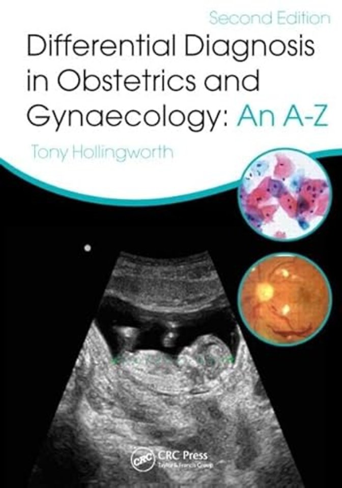 Differential Diagnosis in Obstetrics & Gynaecology