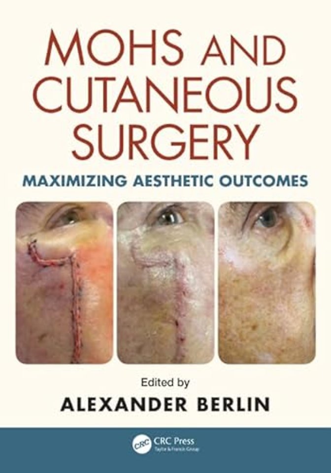 Mohs and Cutaneous Surgery