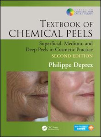 Textbook of Chemical Peels, Second Edition