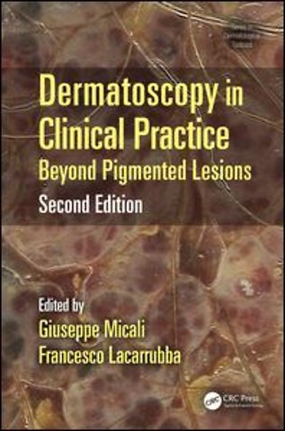 Dermatoscopy in Clinical Practice